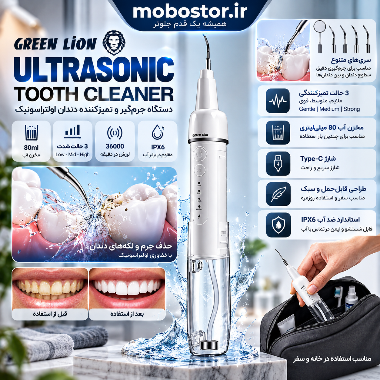 دستگاه تمیزکننده دندان اولتراسونیک گرین لاین مدل GTC-11